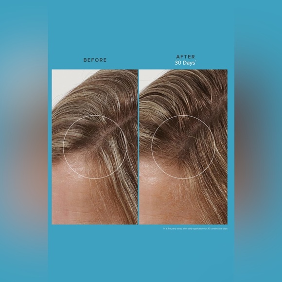 Living proof - Scalp Care Revitalizing Treatment - New! - Picture 4 of 12